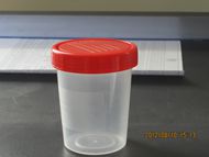 120ml Urine Cup